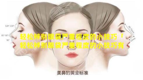 轻松辨别眼袋严重程度的小技巧「轻松辨别眼袋严重程度的小技巧有哪些 🐘 」